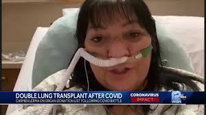 Milwaukee woman gets double lung transplant after battling coronavirus