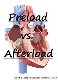 Image result for Preload