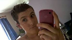 Ako tínedžer sa rozhodol, že bude vyzerať ako Kardashianky: Jeho pery sú  tak veľké, že ich