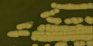 Botulinumtoxin wird von dem bakterium clostridium botulinum gebildet. Rki Infektionskrankheiten A Z Botulismus Clostridium Botulinum
