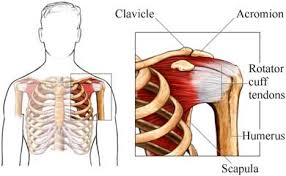 Related online courses on physioplus. Shoulder Tendinopathy Uva Health