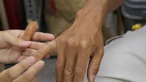 What does a pinky ring on. Prosthetic Fingers Help Reform Japan S Feared Yakuza Gangsters Abc News