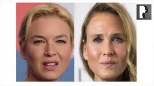 Renee zellweger's face — experts speak about plastic surgery. Renee Zellweger Before And After Plastic Surgery A Comparison Celebrities 2021