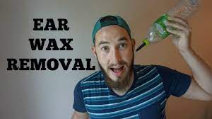 Ear Wax Removal Quick Easy Home Remedy Ear Wax Removal Natural Ear Wax Removal Ear Wax