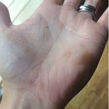 Orange spot removal evaluation site. Orangish Rust Stains On Hands December 2015 Babies Forums What To Expect