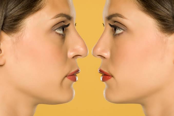What Is Primary Rhinoplasty? First Nose Job Explained