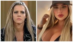 Após transformação radical, Denise Rocha conta quais procedimentos  estéticos realizou