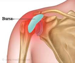 Movements of the human shoulder represent the result of a complex dynamic interplay of structural bony anatomy and biomechanics, static ligamentous and tendinous restraints, and dynamic muscle. Bursitis Shoulder Bursitis Shoulder