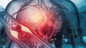 High Cholesterol Can Severely Damage Your Heart: Doctor Shares Easy Steps To Keep Cholesterol Under Control | TheHealthSite.com