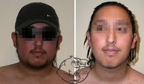 3 however, this treatment is often associated with serious side effects: Evolutionary Org Steroids Research Forums