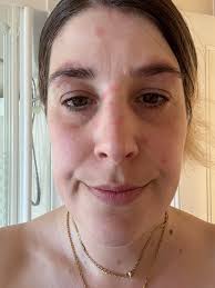 Any success stories with clearing it