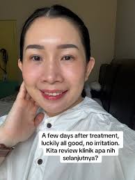 Review Klinik Kecantikan Athena