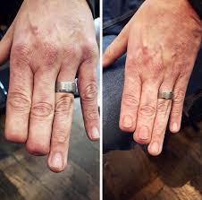 In general, however, most medical facilities apply minor restrictions that only prohibit excessive and/or offensive tattoos. Welcome To The Camouflaged World Of Paramedical Tattoos Health Unionleader Com