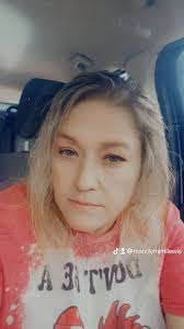 Introduction after hospital stay as amputee