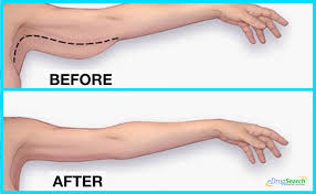 We did not find results for: How To Get Rid Of Flabby Arms 10 Easy Exercises Anyone Can Do