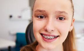 Pediatric Orthodontists in Utah