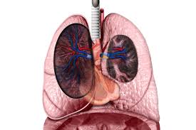 Assessment Of Life Expectancy In Scleroderma Associated Pulmonary Arterial Hypertension Rheumatology Advisor