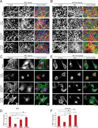 Maybe you would like to learn more about one of these? Yap Nuclear Localization In The Absence Of Cell Cell Contact Is Mediated By A Filamentous Actin Dependent Myosin Ii And Phospho Yap Independent Pathway During Extracellular Matrix Mechanosensing Journal Of Biological Chemistry