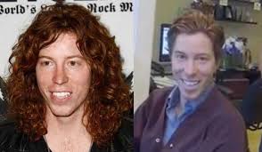 But in the end, with about a foot of hair removed from his head, white was pleased with the outcome. Photo Video Shaun White Cuts Off His Famous Long Red Wavy Hair For Locks Of Love Starcasm Net