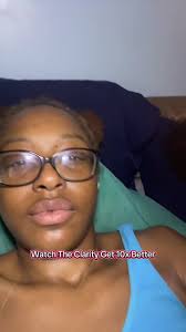 Half moon, full glam✨💫 #24kmaplesupply #EstheticianLighting #Skincare...