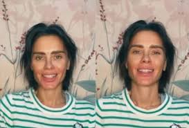 O alerta de Carolina Dieckmmann após ser internada