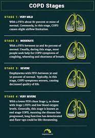 What are the 4 stages of emphysema. Copd Life Expectancy Stages And Prognosis Here Are Your Numbers