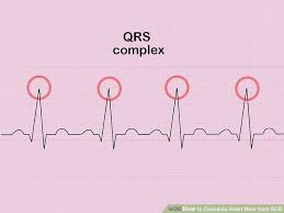 How To Measure And Calculate Heart Rate From Ecg Expert