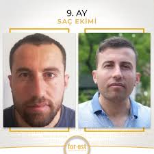 For Est Sac Ekimi Ve Estetik Home Facebook