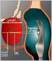 India Prostate Cancer Treatment Cost Hifu Treatment Prostate Cancer