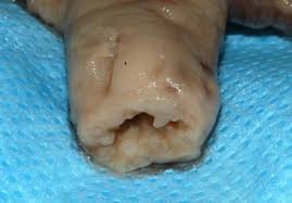 The inner layer of the uterus (womb); Heard Of A Decidual Cast A Doctor Shares The Causes And Cures