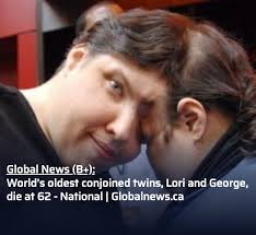 World's oldest conjoined twins, Lori and George, pass away at 62 years old  : r/newswall