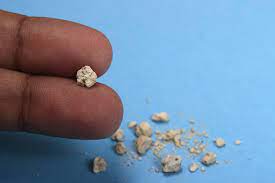 Acest lucru se întâmplă nu numai la persoanele în vârstă. Totul Despre Pietrele La Rinichi Cauze Simptome Tratament Secom Ro