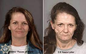 Photos How Methamphetamine Destroys Your Face And Physical Appearance Abc13 Houston