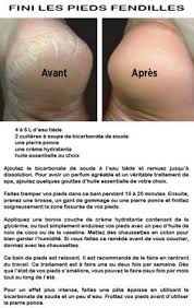 Astuce Naturelle Pour Traiter Les Pieds Secs Et Fendilles Traitement De Pieds Soins Des Pieds Astuce Naturelle