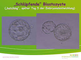 Schwangerschaftswoche sind alle sinnesorgane funktionsfähig, das kind kann sehen. Embryonalentwicklung
