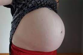 Dein baby misst nun in der 33. 34 Ssw Bauch Plotzlich Sehr Klein Forum Schwangerschaft Urbia De