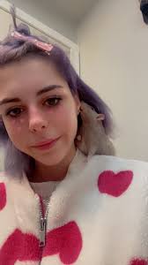 Kissing rats and health risks associated with it