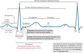 ECG interpretation: Characteristics of the normal ECG (P-wave, QRS complex,  ST segment, T-wave) – The Cardiovascular