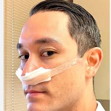 Image result for Sinus Surgery