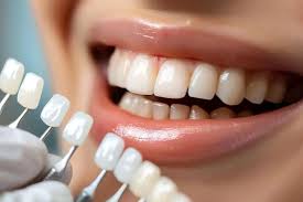 How Cosmetic Dentistry Can Change Your Life