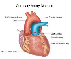We did not find results for: Coronary Artery Disease Liverpool Heart And Chest Hospital