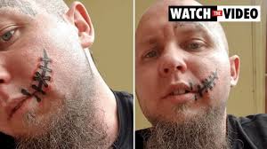 David Coull shot a man in the face with a shotgun