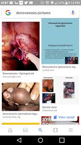 CrazyShit.com | Nastier than Blue Waffles? - Crazy Shit