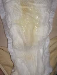 Flujo Amarillo Foto En Comentarios 37 Semanas Club De Bebes Agosto 2018 Babycenter