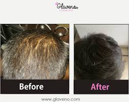 5 hair growth myths you need to know about. Pin On Glaveno S Pins