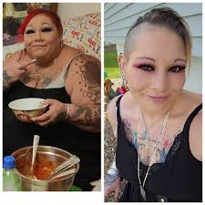 Pictures of myself before and after bariatric surgery