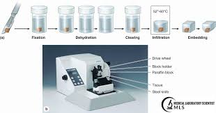 The Technique Of Getting Fixed Tissue Into Paraffin Is Called Tissue Processing Tissue Processing Is Designed To Remove All Extrac Tissue Paraffin Tissue Types