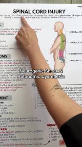 Image result for Spinal Shock