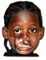 >> on n'attrape pas de lièvre avec un tambour. La Maladie Qui Ronge Sciences Et Avenir