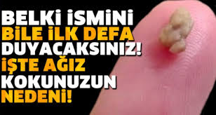 Nedenini Bir Turlu Anlayamadigimiz Agiz Kokusunun Kaynagi Ne Olabilir Agiz Kokusu Saglik Evde Hazirlabilen Ilaclar